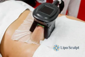 Does Fat Freezing At Home Work? 3 Fat freezing at home from Lipo Sculpt Cleveleys